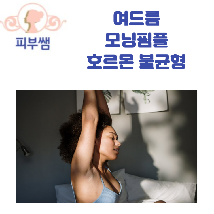  여드름 모닝핌플 호르몬 불균형