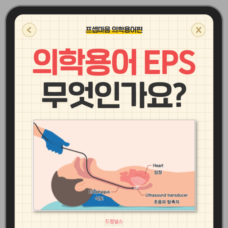 의학용어 EPS 전기생리검사 RFCA 전극도자절제술 의학용어 EPS 전기생리검사 RFCA 전극도자절제술