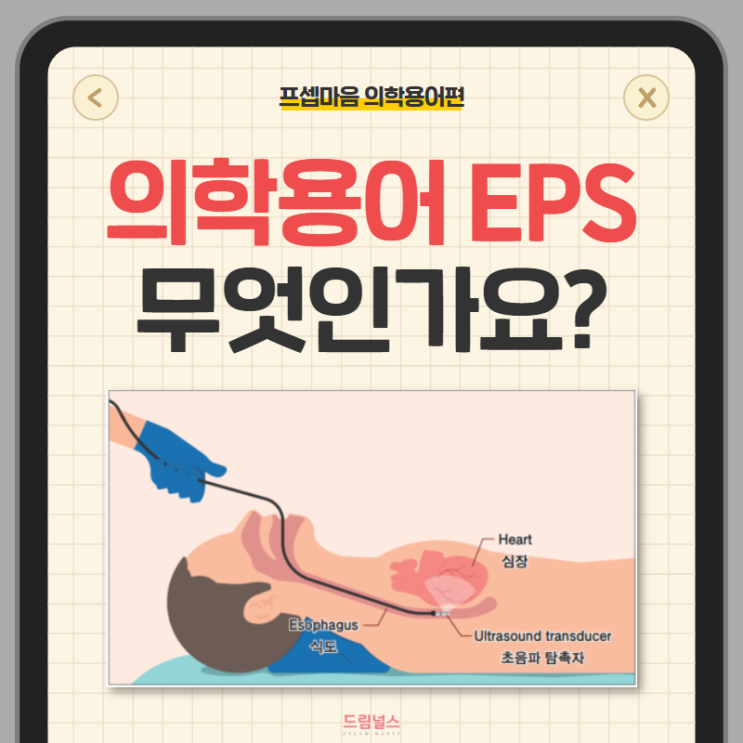 의학용어 EPS 전기생리검사 RFCA 전극도자절제술