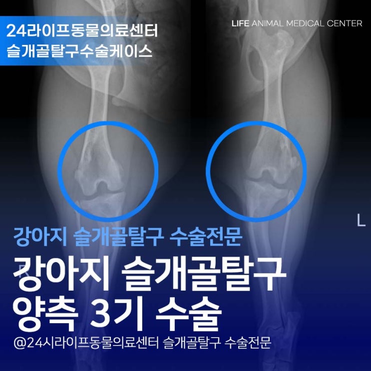 대구 강아지 슬개골 탈구 수술 전문 : 양측 슬개골 3기 수술 24시라이프동물의료센터