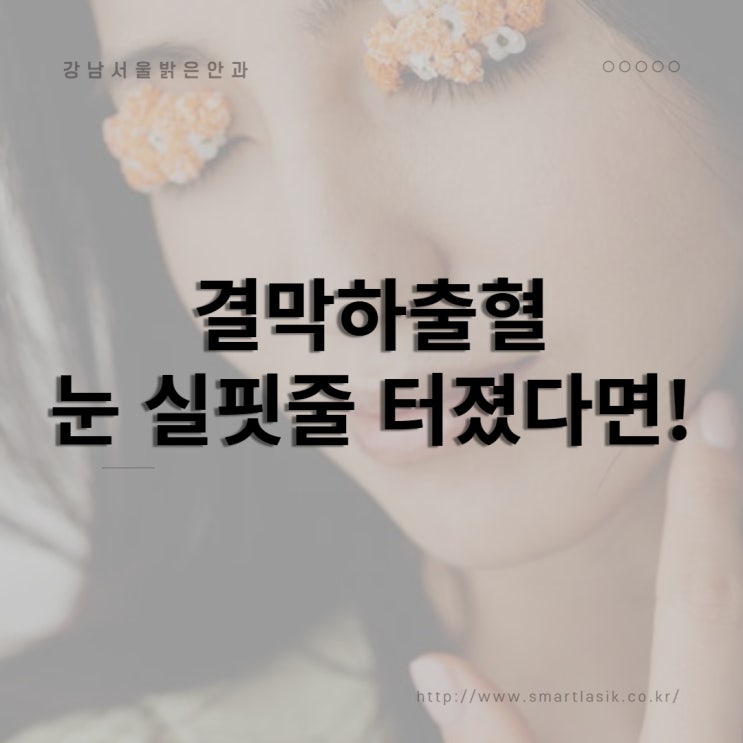  결막하출혈 원인과 이유, 눈 실핏줄 치료방법과 예방법, 빠르게 호전시키는 방법