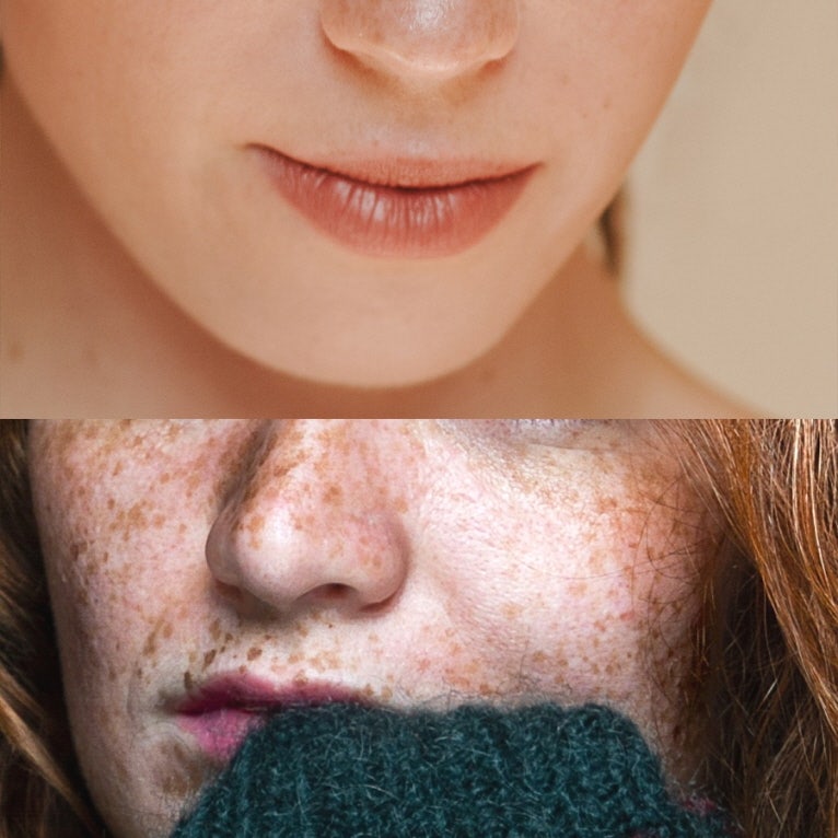 주근깨를 없애는 방법을 알아보겠습니다