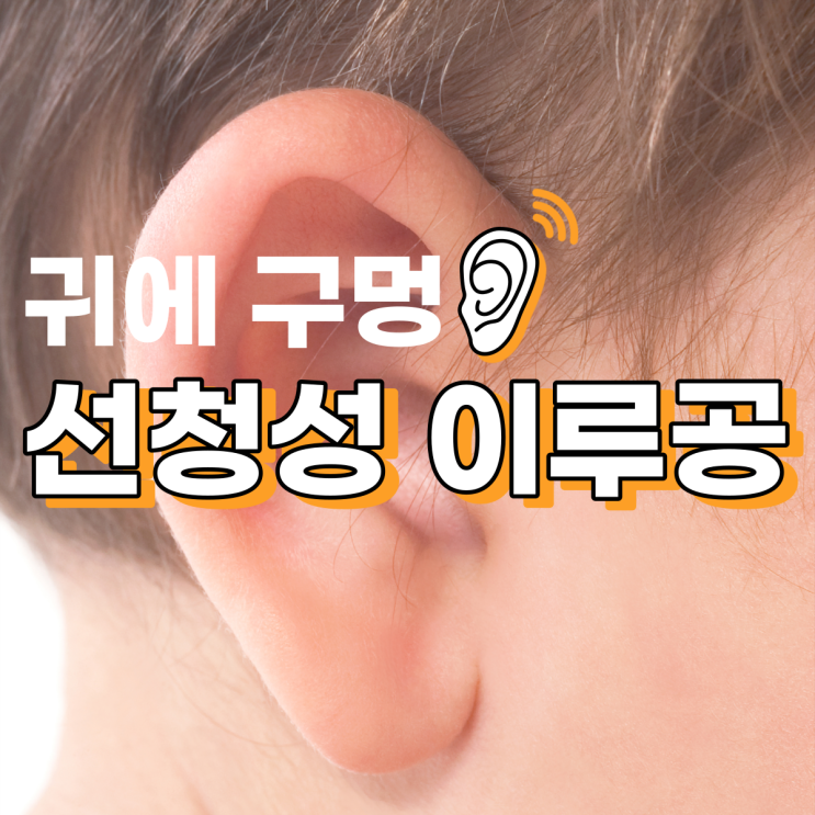  선천성 이루공 귀에 작은 구멍 원인 수술 (전이개누공)