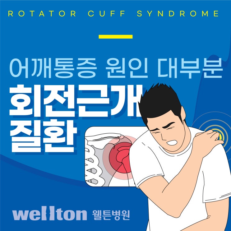  강서구어깨병원 통증 원인 대부분 회전근개질환 이라고?