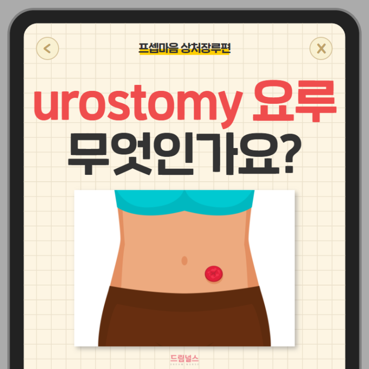urostomy 요루 정의, 적응증, 종류, 관리법 urostomy 요루 정의, 적응증, 종류, 관리법