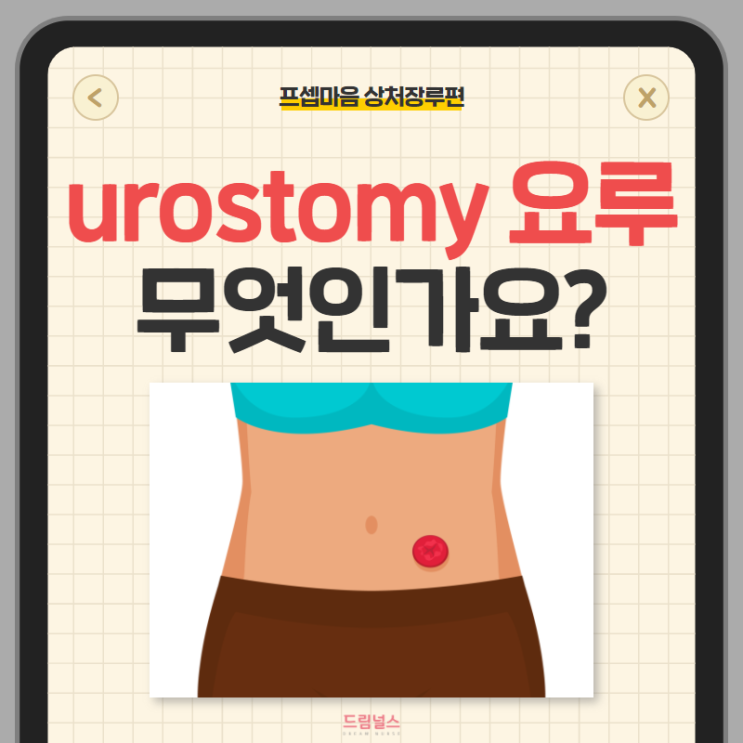 urostomy 요루 정의, 적응증, 종류, 관리법