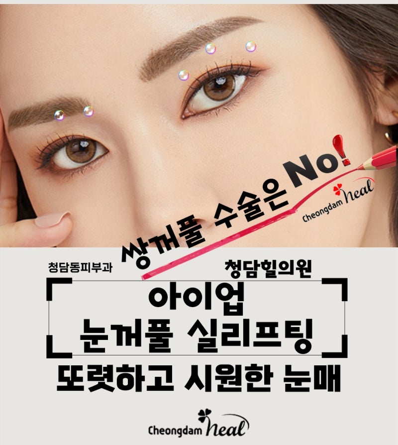 천안 눈꺼풀 처짐 리프팅으로 어려보여요