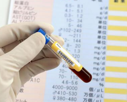  LDL 콜레스테롤 수치 정상 및 다른 수치 정리