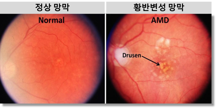  루테인과 지아잔틴은 같이 복용해야!