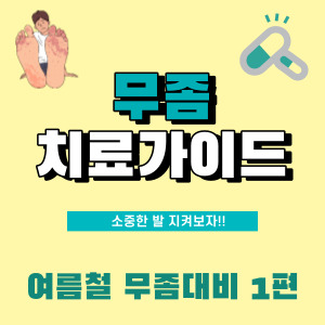  여름철 심해지는 무좀! 어떤 무좀약을 바르고 어떻게 관리해야 할까? (발 무좀 증상, 치료, 생활습관까지) (1)