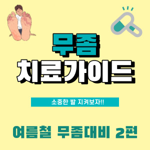  여름철 심해지는 무좀! 어떤 무좀약을 바르고 어떻게 관리해야 할까? (발 무좀 증상, 치료, 생활습관까지) (2)