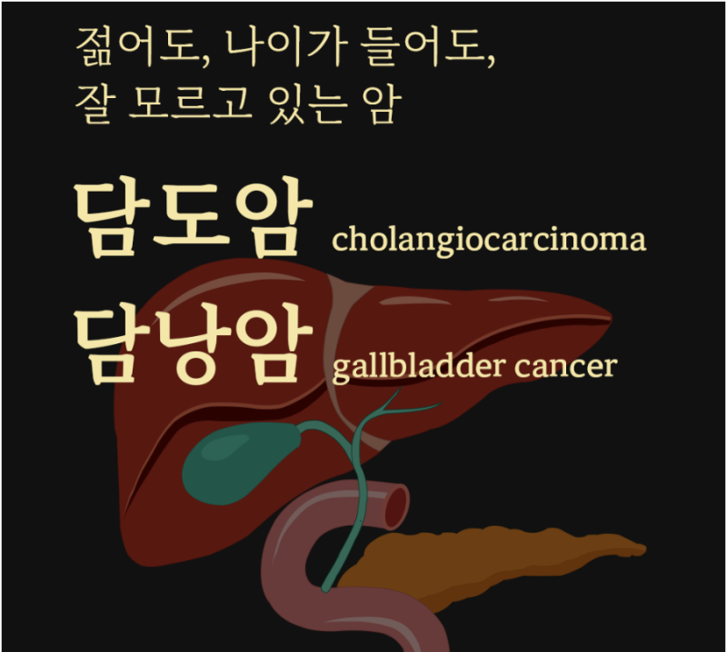 잘 모르고 있는 암, 담도암 담낭암 명의 찾기