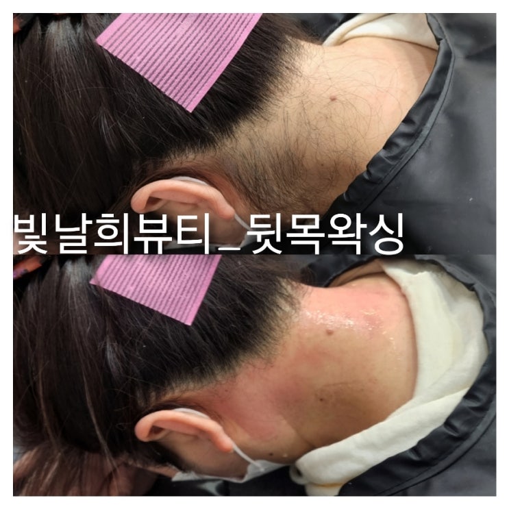  양산빛날희왁싱에서 뒷목왁싱으로 깔끔해지세요호호