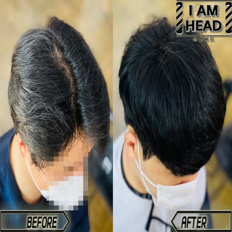  [캠페인 2주차] 오랫동안 갈라져있던 가르마여 안녕! 가르마교정하는법 { 링거펌} 