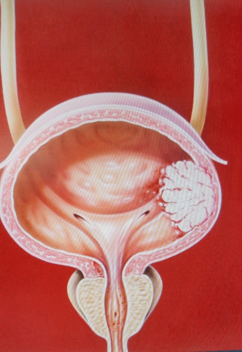 PowerPoint 프레젠테이션, image size:800x1164