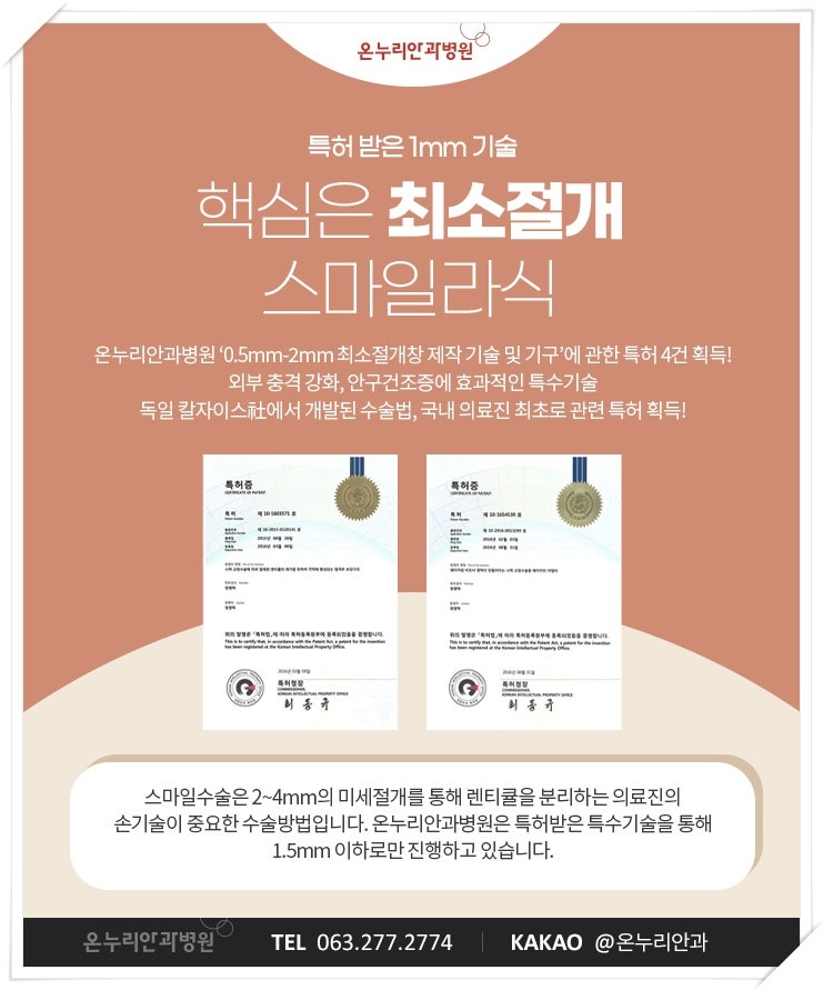 [2022] 스마일라식비용 차이 발생 중요한 이유 9