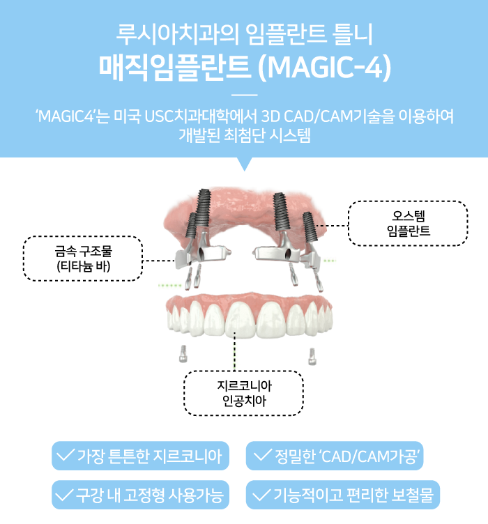 노인용 임플란트 틀니 가격을 비교해 보면 3