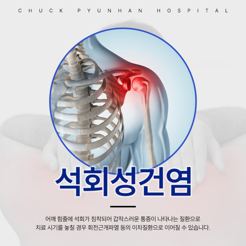 (관악구정형외과) 관악구 어깨 석회화건염의 첫 치료는?