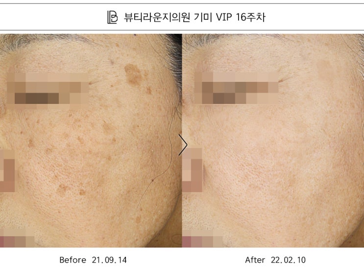  뷰티라운지의원마곡 흑자 원인과 제거법