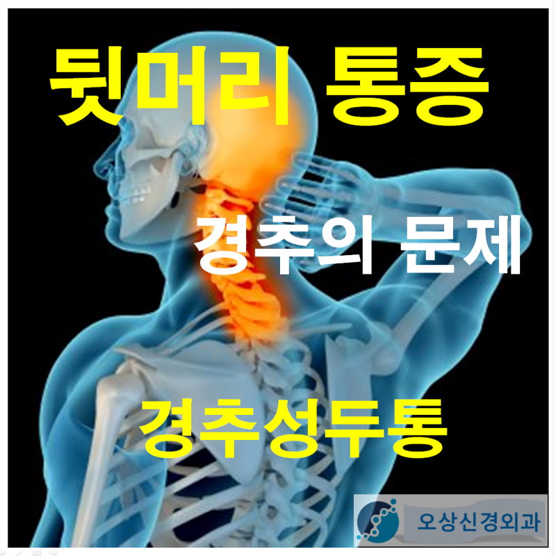 왼쪽 등 머리 통증의 원인과 치료법을 알아보세요 4