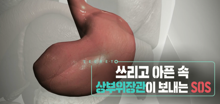  상부위장관 방치하면 안되는 이유