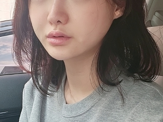  얼굴필라테스바이지 신사동 얼굴경락 얼굴부종 고민에 By G 페이스필라테스