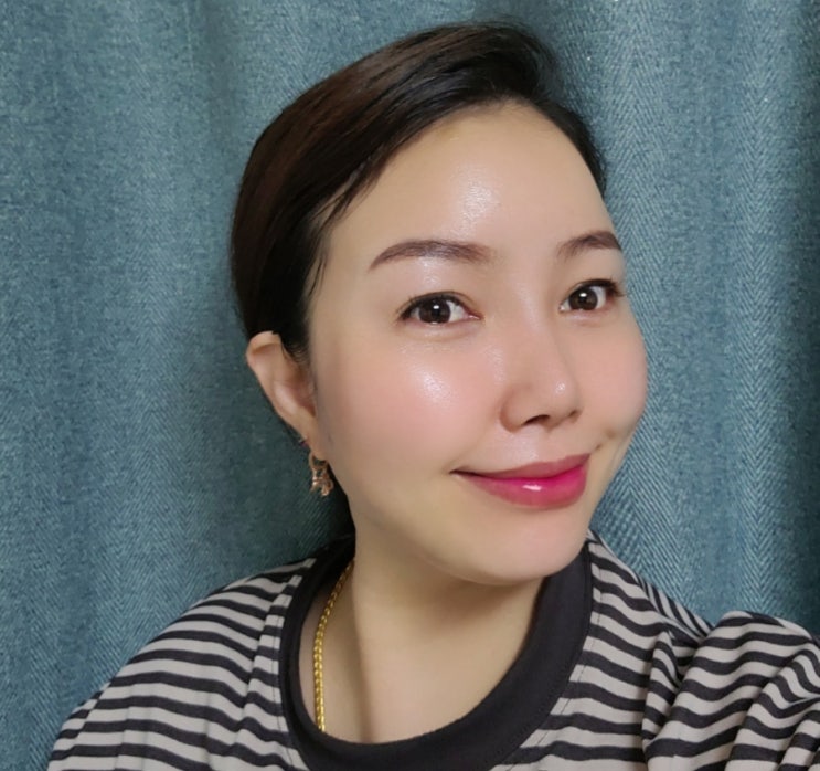  안산 레이저토닝으로 색소 관리했어요