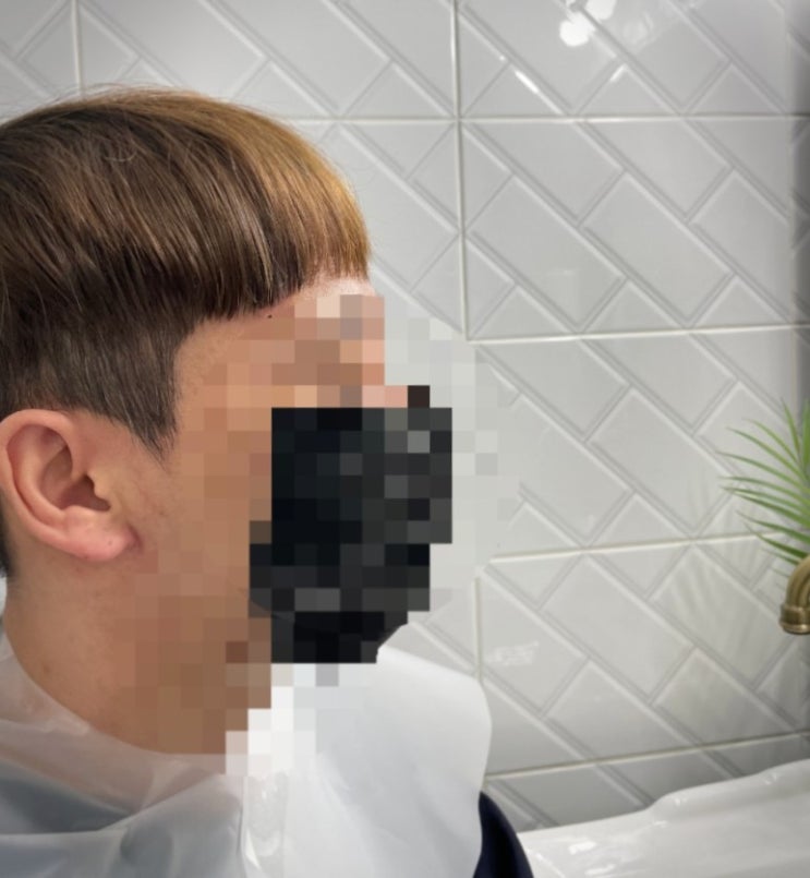  천안탈모 M자 다증모 증모술 천안24시 미용실 두정동 옴브레헤어살롱