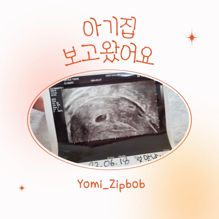  [시험관 성공] 초음파로 아기집과 난황 보고 왔어요~