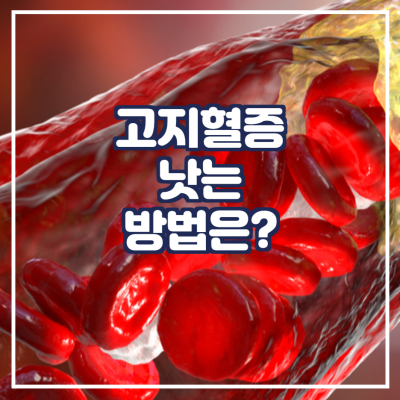  고지혈증 낫는 방법이 뭔가요?