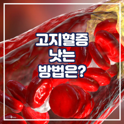 고지혈증 낫는 방법이 뭔가요?