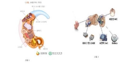 (포낙보청기 목포) 보청기 배터리 사용에 관해..