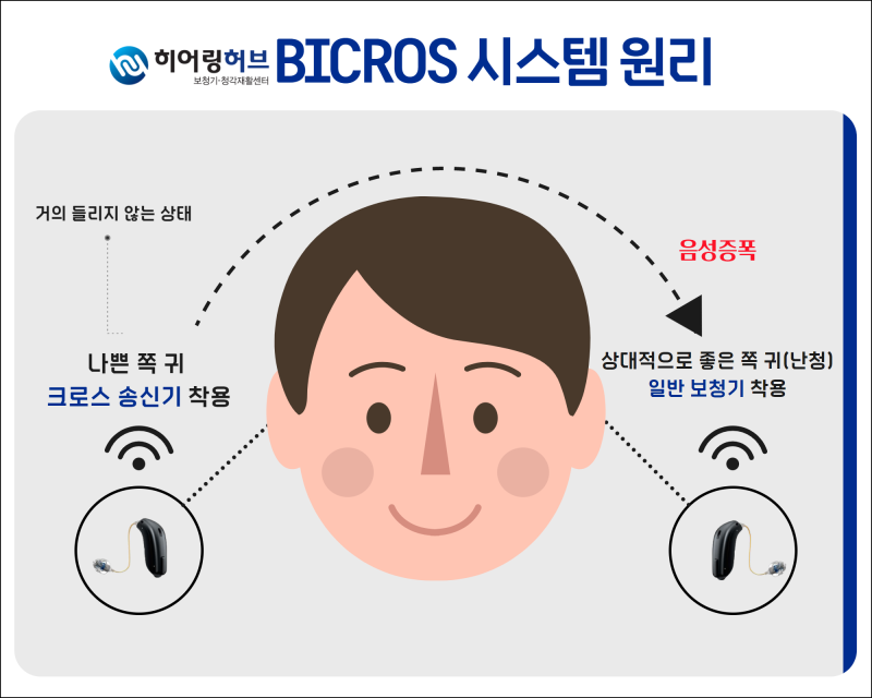 [리사운드 보청기] 편측성 난청, 한쪽 귀 안 들릴 땐 어떤 보청기 착용해야 할까? 3