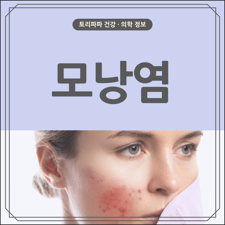  장시간 마스크 착용으로 인하여 발생할 수 있는 모낭염(Folliculitis)의 원인과, 증상, 치료