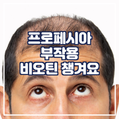 프로페시아 부작용? 비오틴부터 챙겨요