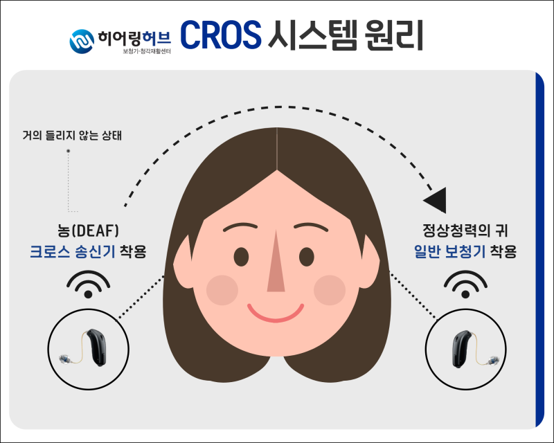 [리사운드 보청기] 편측성 난청, 한쪽 귀 안 들릴 땐 어떤 보청기 착용해야 할까?