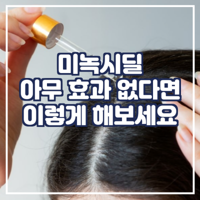  미녹시딜 아무 효과 없다면 이렇게 해보세요