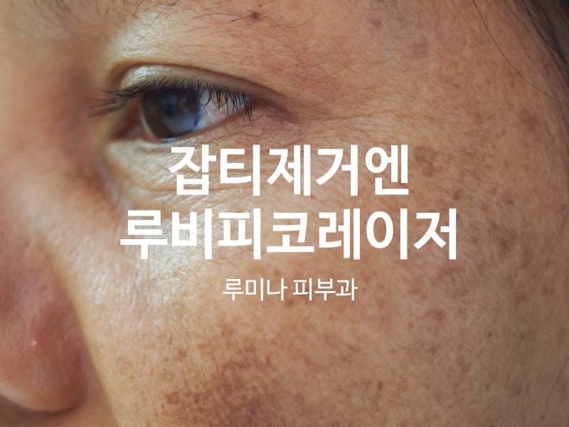 용인 색소침착레이저토닝_인라이튼