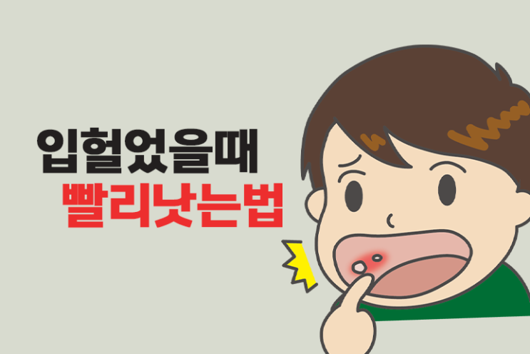  입헐었을때 빨리 낫는법 구내염 약