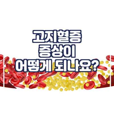  고지혈증 증상이 어떻게 되나요?