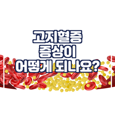 고지혈증 증상이 어떻게 되나요?