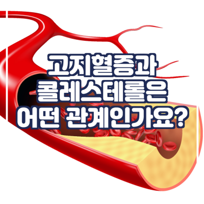  고지혈증과 콜레스테롤은 어떤 관계인가요?