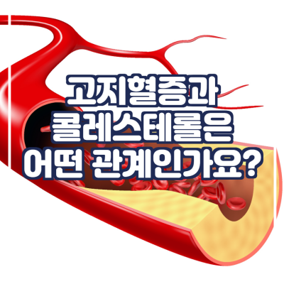 고지혈증과 콜레스테롤은 어떤 관계인가요?