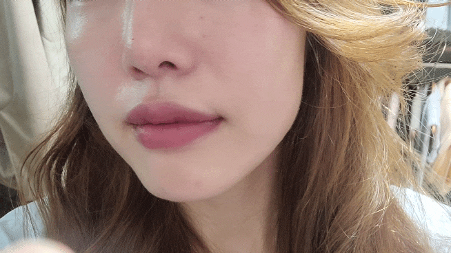 구월동피부과 속건조 리쥬란힐러 후기 물광 대박이에요 (+가격) 구월동피부과 속건조 리쥬란힐러 후기 물광 대박이에요 (+가격)
