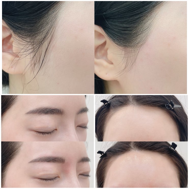 부평왁싱샵 하에르뷰티 피부톤업 화장잘먹는 페이스전체왁싱 후기