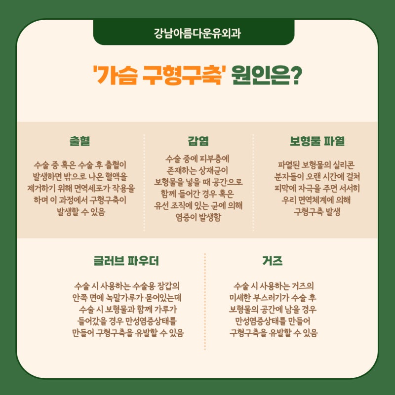 유방 캡슐 구축 이해
