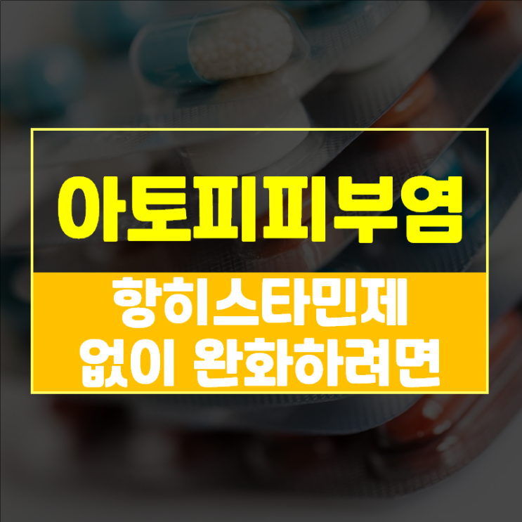  아토피가려움 항히스타민제 없이 완화하려면