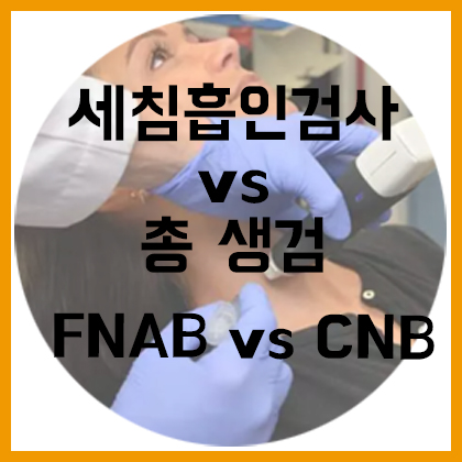  [목] 세침흡인검사 vs 총생검