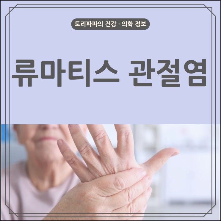  손마디가 붓고, 통증이 심한 류마티스 관절염의 원인 및 증상, 치료(의학용어 RA)