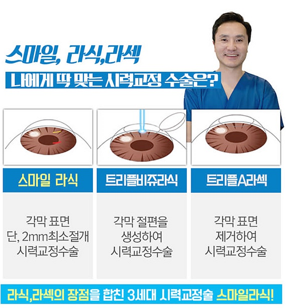 압구정라식, 잘하는 곳의 특징 <강남 안과 원장>
